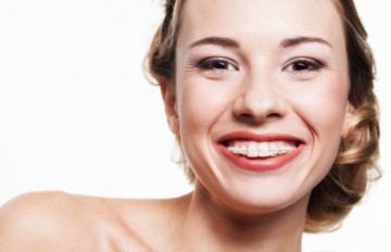photodune-4465792-smile-with-dental-braces-s-555x358